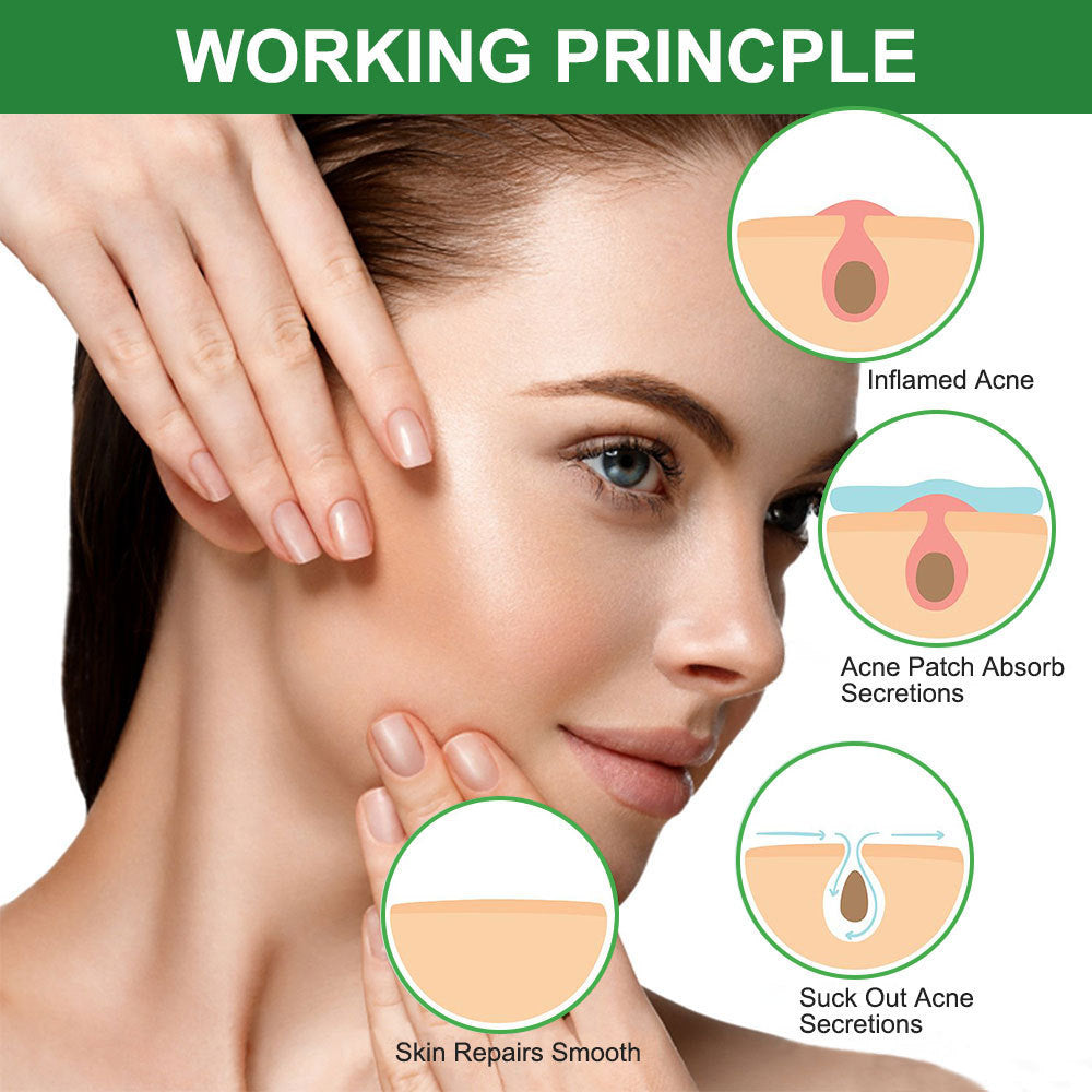 Colloidal Acne Patches
